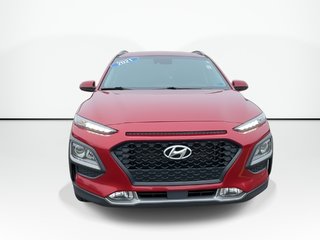 2021 Hyundai Kona Luxury | Lthr | Roof | Htd Whl | Alloy | Bluetooth in Saint John, New Brunswick - 5 - w320h240px
