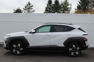 2024 Hyundai Kona Preferred Trend | Lthr | Roof | Warranty to 2029 in Saint John, New Brunswick - 4 - w320h240px