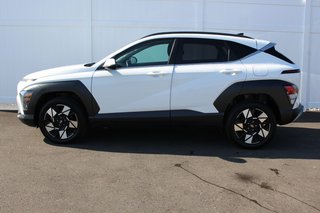Hyundai Kona Preferred Trend | Roof | Cam | Warranty to 2029 2024 à Saint John, Nouveau-Brunswick - 4 - w320h240px