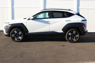 2024 Hyundai Kona in Antigonish, Nova Scotia - 4 - w320h240px