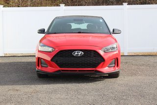 2020 Hyundai Veloster in Antigonish, Nova Scotia - 2 - w320h240px