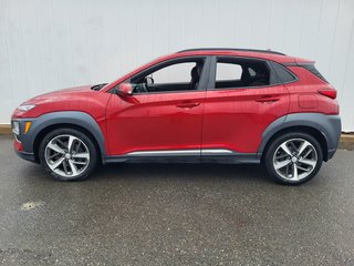 2021 Hyundai Kona Ultimate | Leather | SunRoof | Cam | USB | HtdSeat in Saint John, New Brunswick - 6 - w320h240px