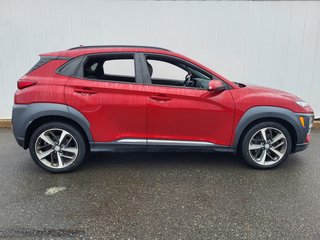 2021 Hyundai Kona Ultimate | Leather | SunRoof | Cam | USB | HtdSeat in Saint John, New Brunswick - 2 - w320h240px