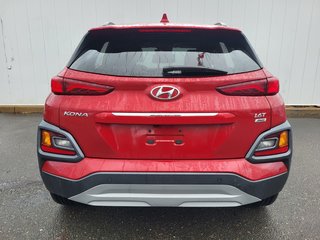 2021 Hyundai Kona Ultimate | Leather | SunRoof | Cam | USB | HtdSeat in Saint John, New Brunswick - 4 - w320h240px