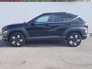 Hyundai Kona Trend | Leather | Sunroof | Cam | USB | HtdWheel 2024 à Saint John, Nouveau-Brunswick - 4 - w320h240px