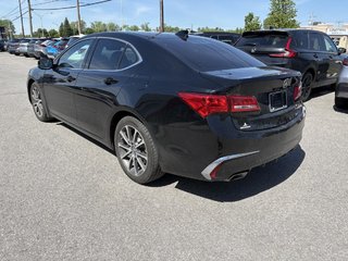 2018 Acura TLX SH-AWD  3.5L I LEATHER I SUNROOF I MAGS I STARTER I CARPLAY in Montréal, Quebec - 4 - w320h240px