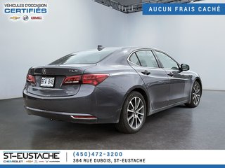 Acura TLX  2017 à Saint-Eustache, Québec - 5 - w320h240px