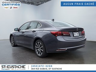 Acura TLX  2017 à Saint-Eustache, Québec - 6 - w320h240px