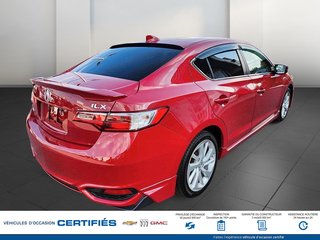 Acura ILX  2017 à Alma, Québec - 4 - w320h240px