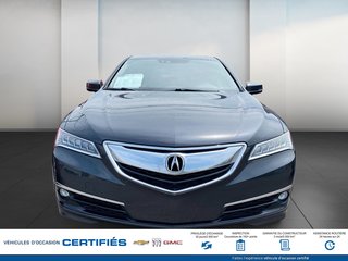 Acura TLX  2016 à Alma, Québec - 2 - w320h240px
