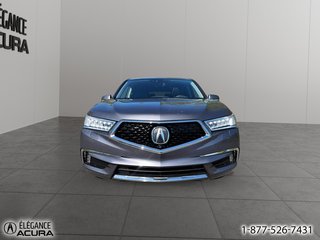 2017 Acura MDX Elite Pkg in Granby, Quebec - 2 - w320h240px