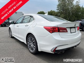 Acura TLX Elite 2018 à Granby, Québec - 5 - w320h240px