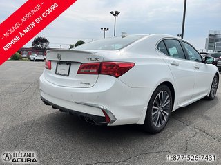 Acura TLX Elite 2018 à Granby, Québec - 4 - w320h240px