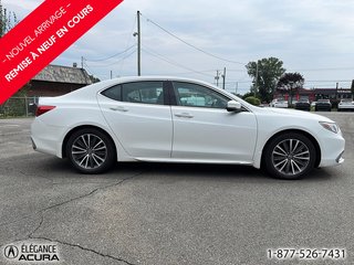 Acura TLX Elite 2018 à Granby, Québec - 3 - w320h240px