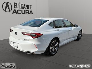 Acura TLX  2021 à Granby, Québec - 5 - w320h240px