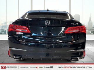 Acura TLX TECH + TOIT OUVRANT + CUIR 2019 à Pointe-Aux-Trembles, Québec - 3 - w320h240px