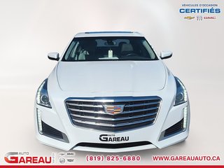 Cadillac CTS Sedan  2017 à Val-d'Or, Québec - 2 - w320h240px
