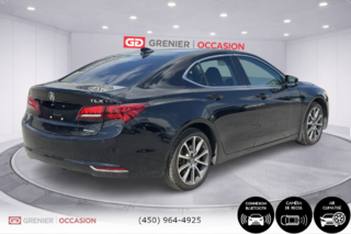 2017 Acura TLX V6 Elite in Terrebonne, Quebec - 2 - w320h240px