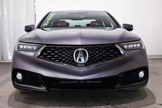 Acura TLX SH-AWD A-SPEC + TOIT OUVRANT + CARPLAY 2020 à Terrebonne, Québec - 2 - w320h240px