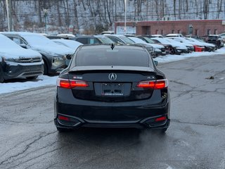 Acura ILX Premium Cuir Toit Ouvrant 2016 à Terrebonne, Québec - 5 - w320h240px