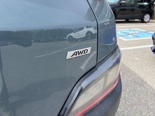 2022 Hyundai Kona Preferred in Miramichi, New Brunswick - 5 - w320h240px