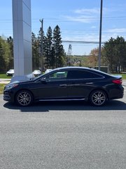 2017 Hyundai Sonata 2.0T Sport Ultimate in Miramichi, New Brunswick - 4 - w320h240px
