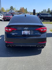 2017 Hyundai Sonata 2.0T Sport Ultimate in Miramichi, New Brunswick - 6 - w320h240px
