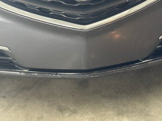 2017 Acura TLX V6 ELITE in Saint-Jean-Sur-Richelieu, Quebec - 3 - w320h240px