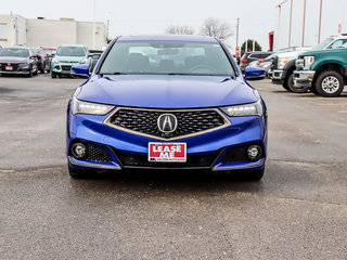 2020 Acura TLX SH-AWD w/Advance Package | A-Spec | Loaded with Navigation | Pwr Roof | Alloys | Keyless | Remote Start