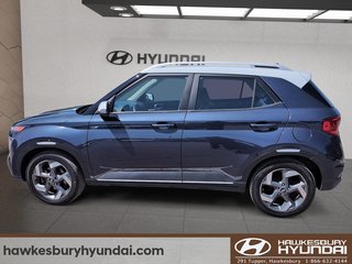 2022 Hyundai Venue Urban in Hawkesbury, Ontario - 5 - w320h240px