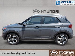 2024 Hyundai Venue ULTIMATE TOIT OUVRANT in Hawkesbury, Ontario - 5 - w320h240px