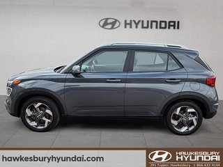 2025 Hyundai Venue Ultimate in Hawkesbury, Ontario - 5 - w320h240px