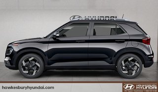 2026 Hyundai Venue Ultimate - Black interior in Hawkesbury, Ontario - 2 - w320h240px