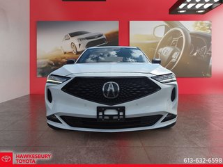 2022 Acura MDX SH AWD A-Spec in Hawkesbury, Ontario - 2 - w320h240px