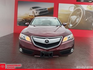 2015 Acura RDX TECHNOLOGIE PACKAGE in Hawkesbury, Ontario - 2 - w320h240px