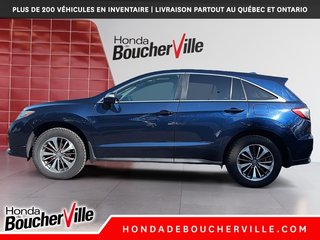 2017 Acura RDX Elite Pkg in Terrebonne, Quebec - 3 - w320h240px