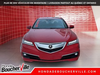 2017 Acura TLX V6 Elite in Terrebonne, Quebec - 3 - w320h240px