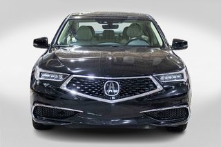 2019 Acura TLX Tech in Charlemagne, Quebec - 2 - w320h240px