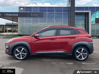 2018 Hyundai Kona Ultimate