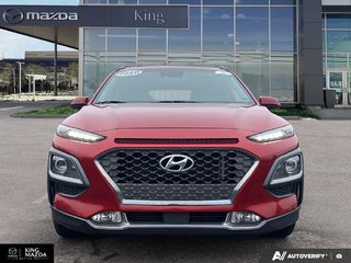 2018 Hyundai Kona Ultimate