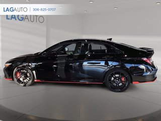 2024 Hyundai Elantra N BASE in Lloydminster, Saskatchewan - 5 - w320h240px