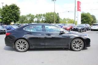2016 Acura TLX Elite | AWD in Gatineau, Quebec - 6 - w320h240px