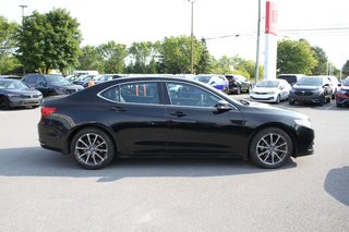 2016 Acura TLX Elite | AWD in , Quebec - 6 - w320h240px