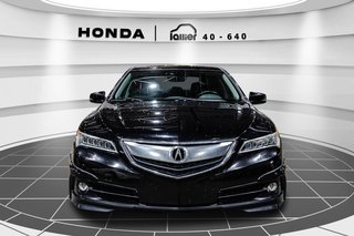Acura TLX V6 Elite 2016 à Lachenaie, Québec - 2 - w320h240px