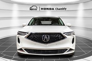 Acura MDX Tech SH-AWD V6 I TOIT OUVRANT I CUIR I MAGS I SIEGES CHAUFFANTS I CARPLAY I SECURITE ACTIVE 2022 à Montréal, Québec - 2 - w320h240px