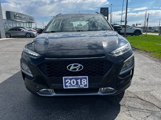 2018 Hyundai Kona Preferred - One Owner