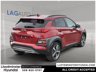 2019 Hyundai Kona 1.6T Ultimate in Lloydminster, Saskatchewan - 5 - w320h240px