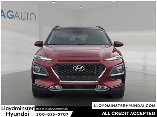 2019 Hyundai Kona 1.6T Ultimate in Lloydminster, Saskatchewan - 2 - w320h240px