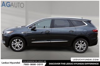 2020 Buick Enclave Avenir in Leduc, Alberta - 5 - w320h240px