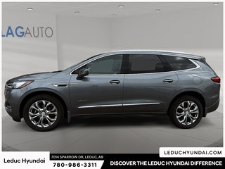 2020 Buick Enclave Avenir in Leduc, Alberta - 5 - w320h240px